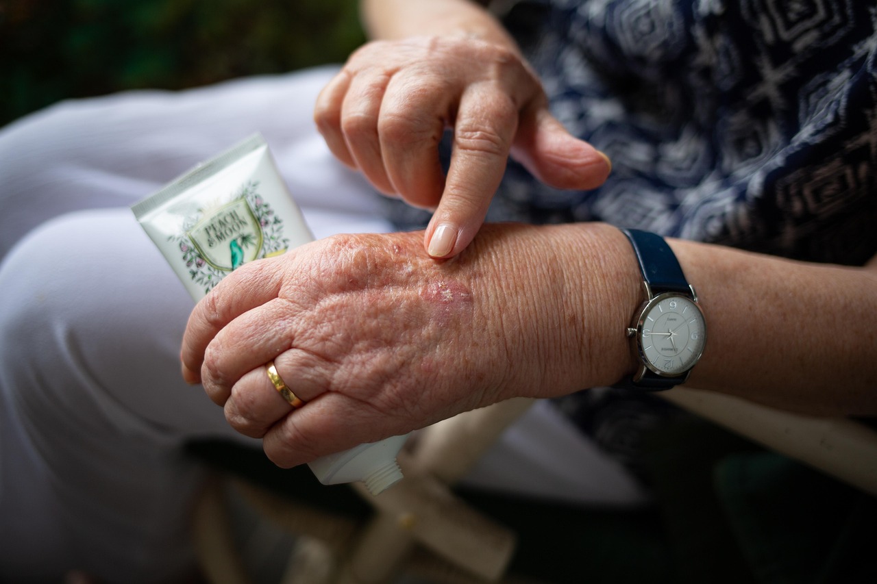 erfahren sie alles über arthritis: ursachen, symptome und behandlungsmöglichkeiten. informieren sie sich über tipps zur linderung von gelenkschmerzen und zur verbesserung ihrer lebensqualität bei arthritis.